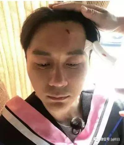 李晨爆料李四最新视频播放,播放量惊人! 第1张 李晨爆料李四最新视频播放,播放量惊人! 第1张